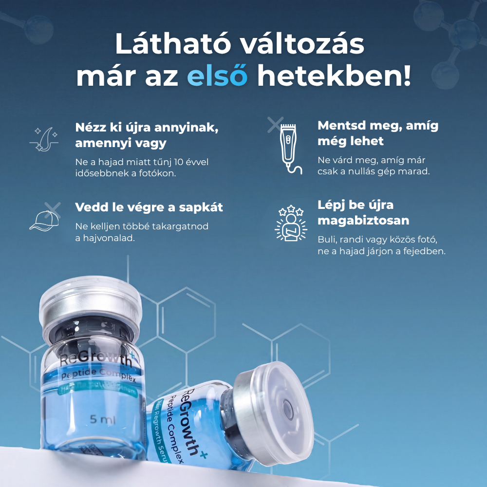 Mikrotűs Hajnövesztő Rendszer