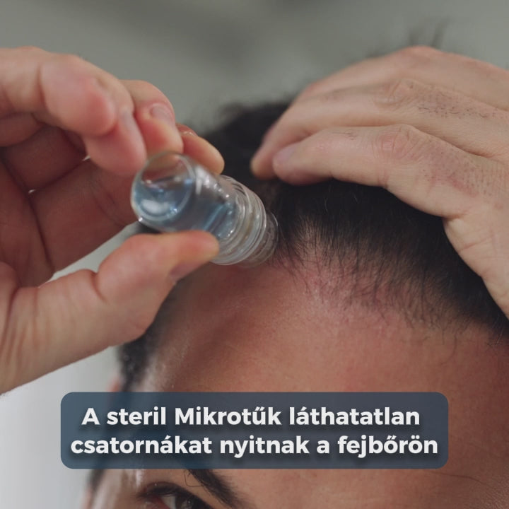Mikrotűs Hajnövesztő Rendszer